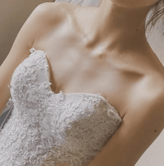 웨딩드레스 착용 시 가슴 라인